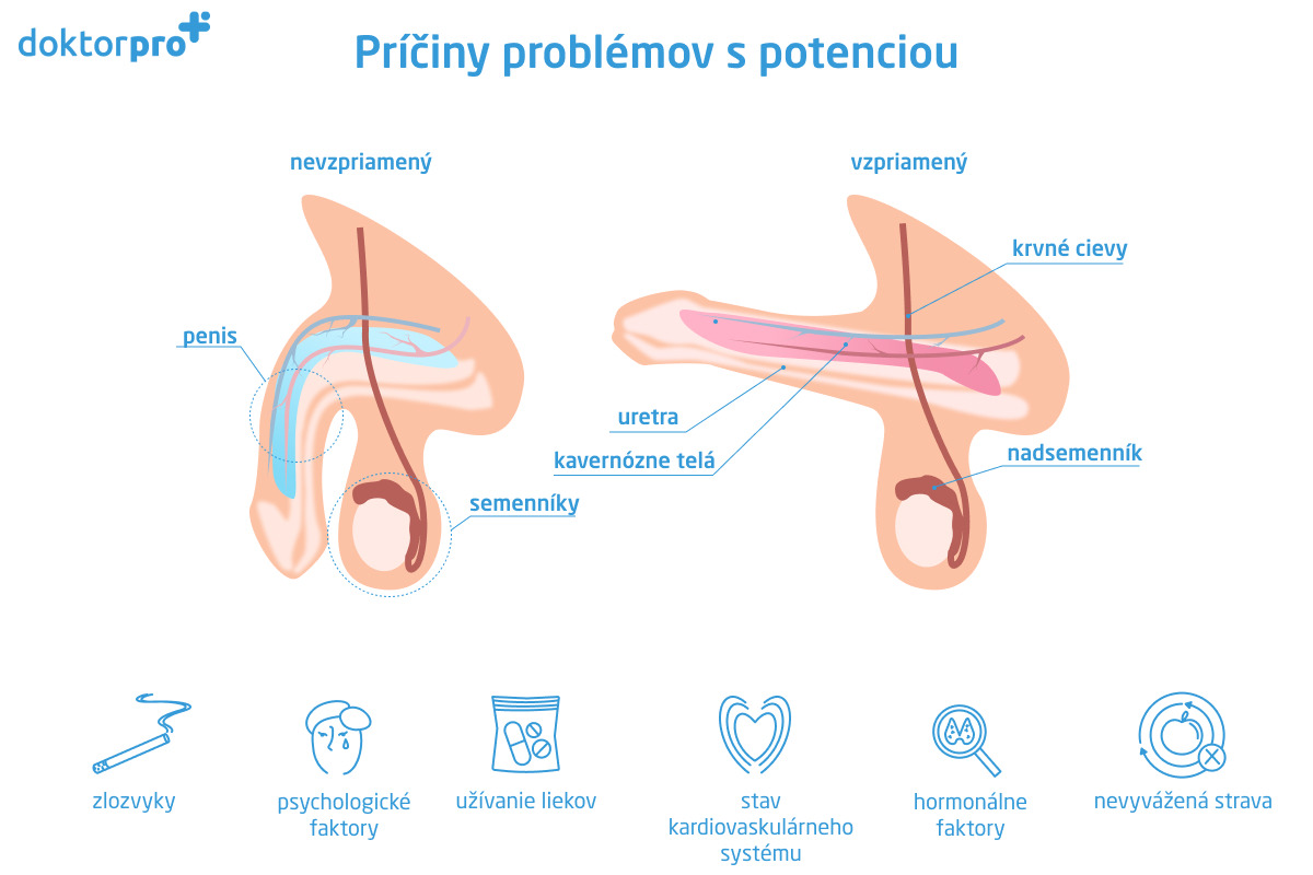 Príčiny problémov s potenciou