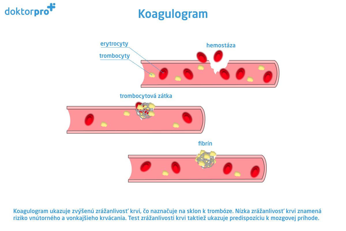 Koagulogram