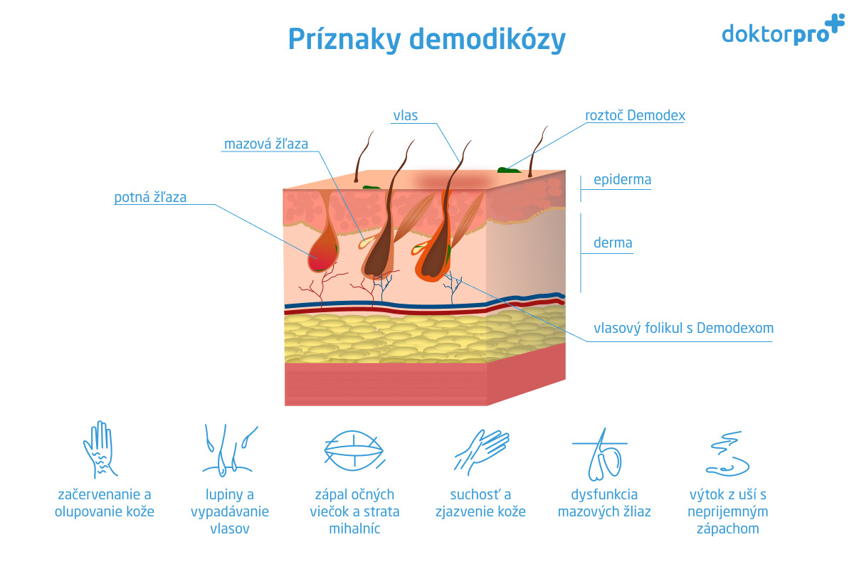 Príznaky demodikózy