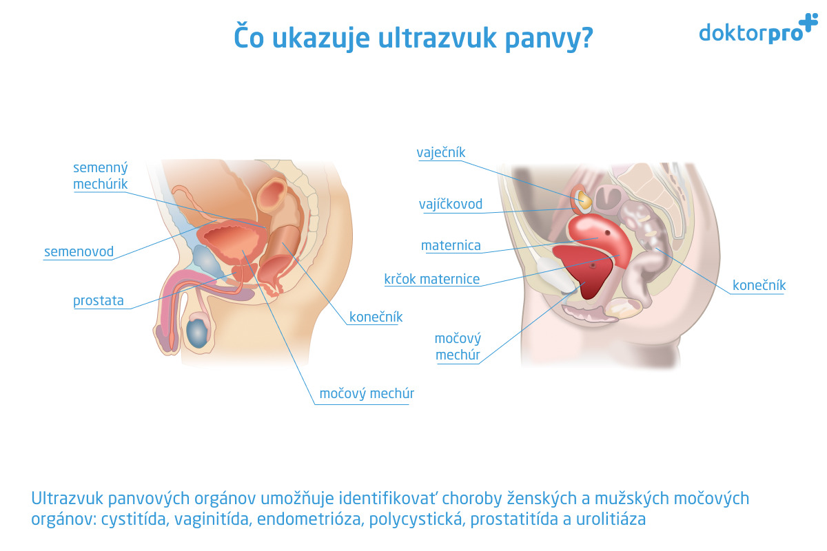 Čo ukazuje ultrazvuk panvy?