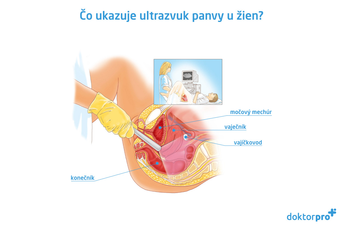 Čo ukazuje ultrazvuk panvy u žien?