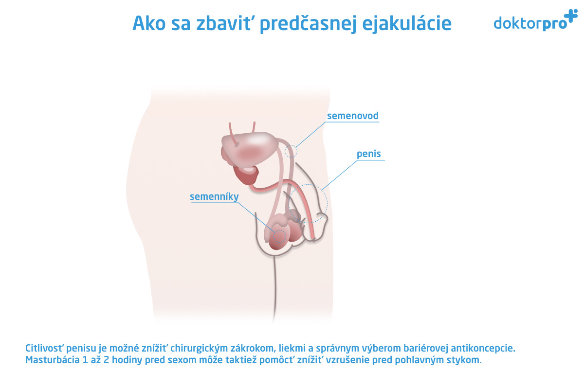 Ako sa zbaviť predčasnej ejakulácie