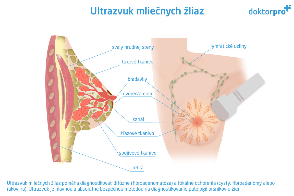 Ultrazvuk mliečnych žliaz