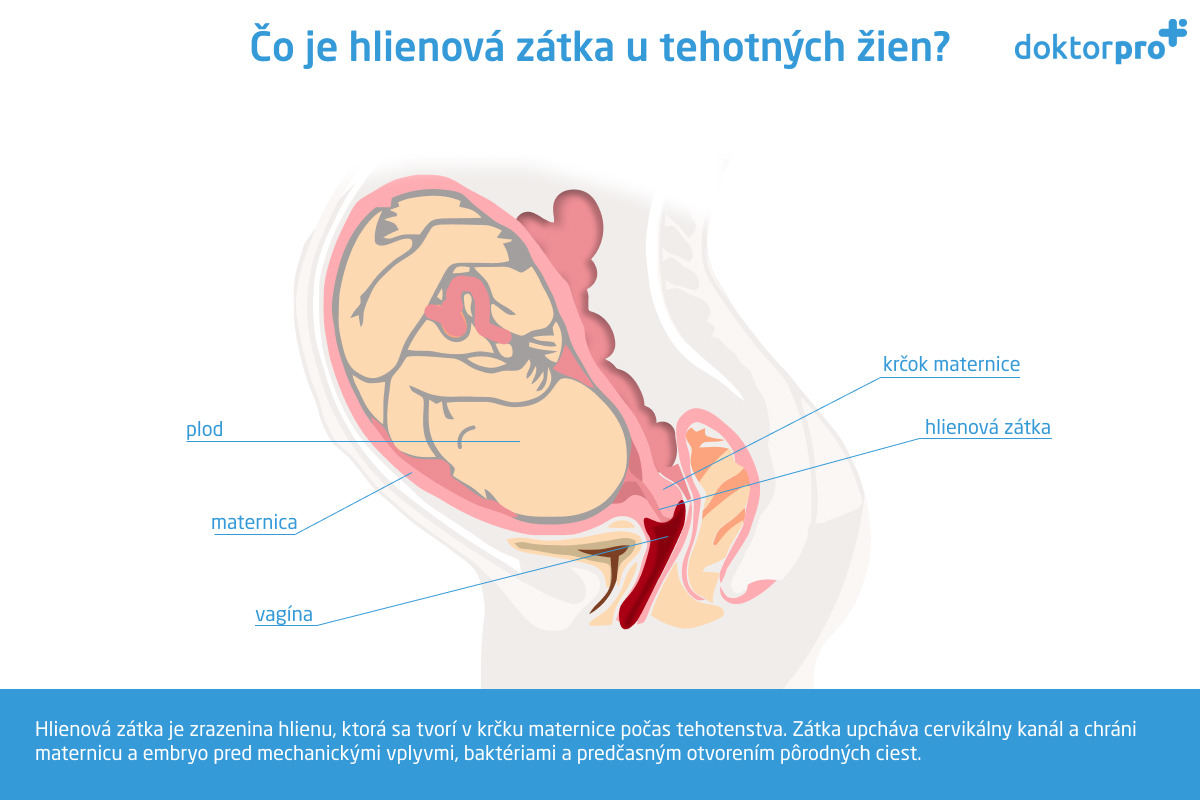 Čo je hlienová zátka u tehotných žien?