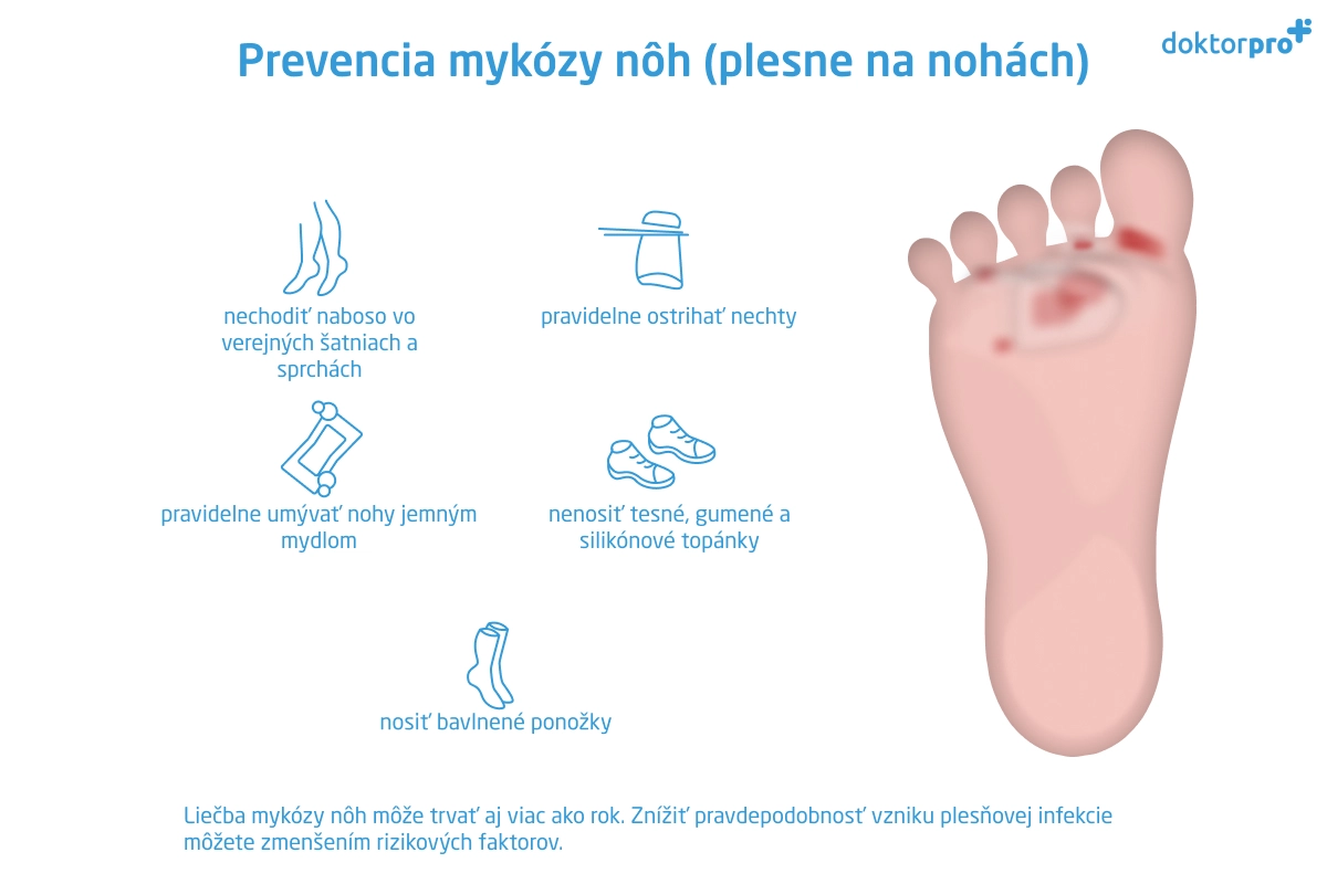 Prevencia mykózy nôh (plesne na nohách)