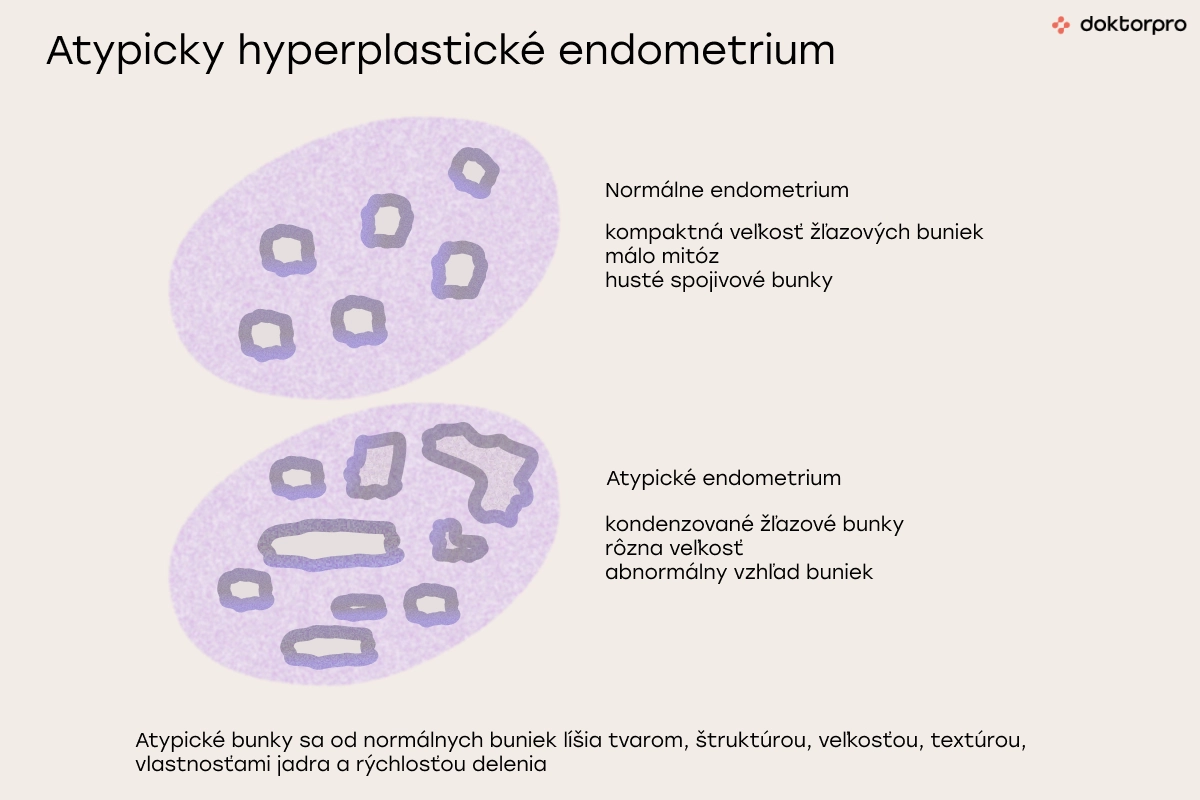 Atypicky hyperplastické endometrium