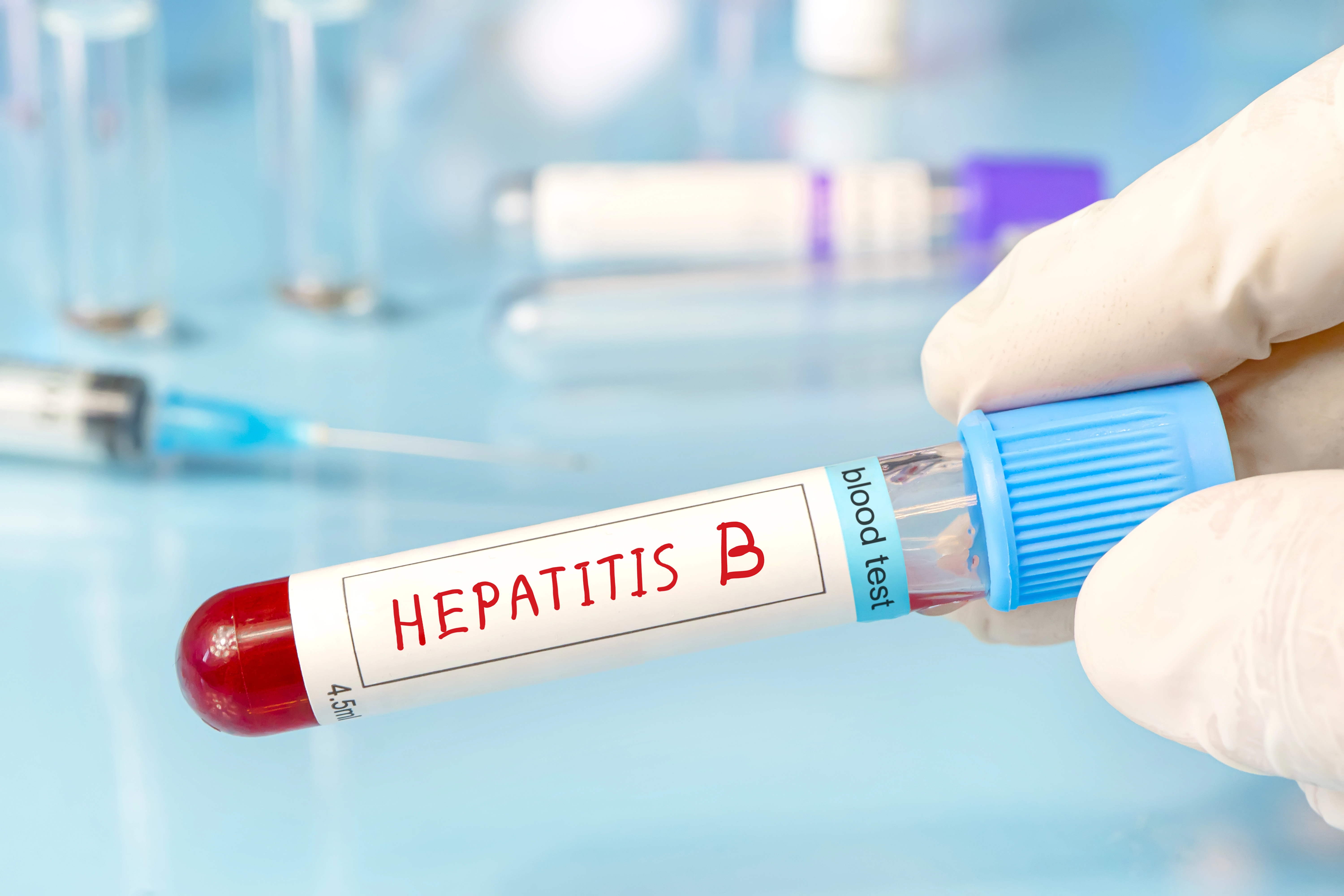 Hepatitída B: príznaky, cesty nákazy, metódy diagnostiky a liečby