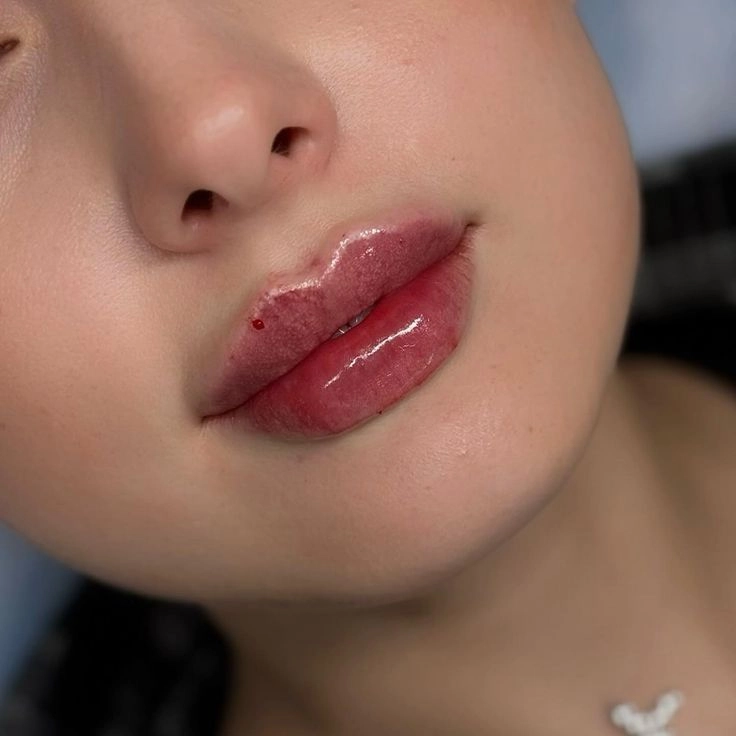 Tvar zväčšenia pier technikou Russian lips