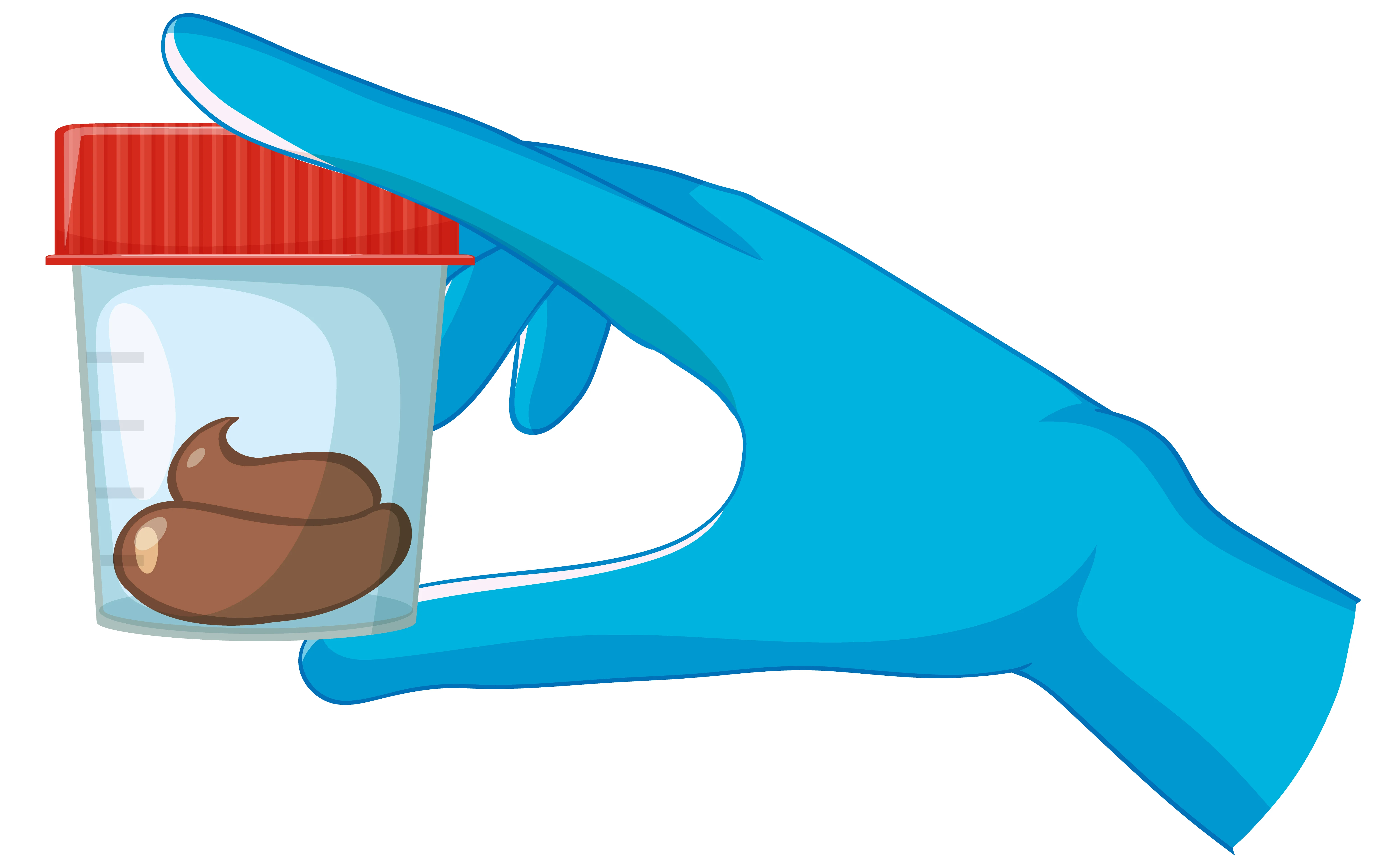 Čo je bakteriologický test stolice?