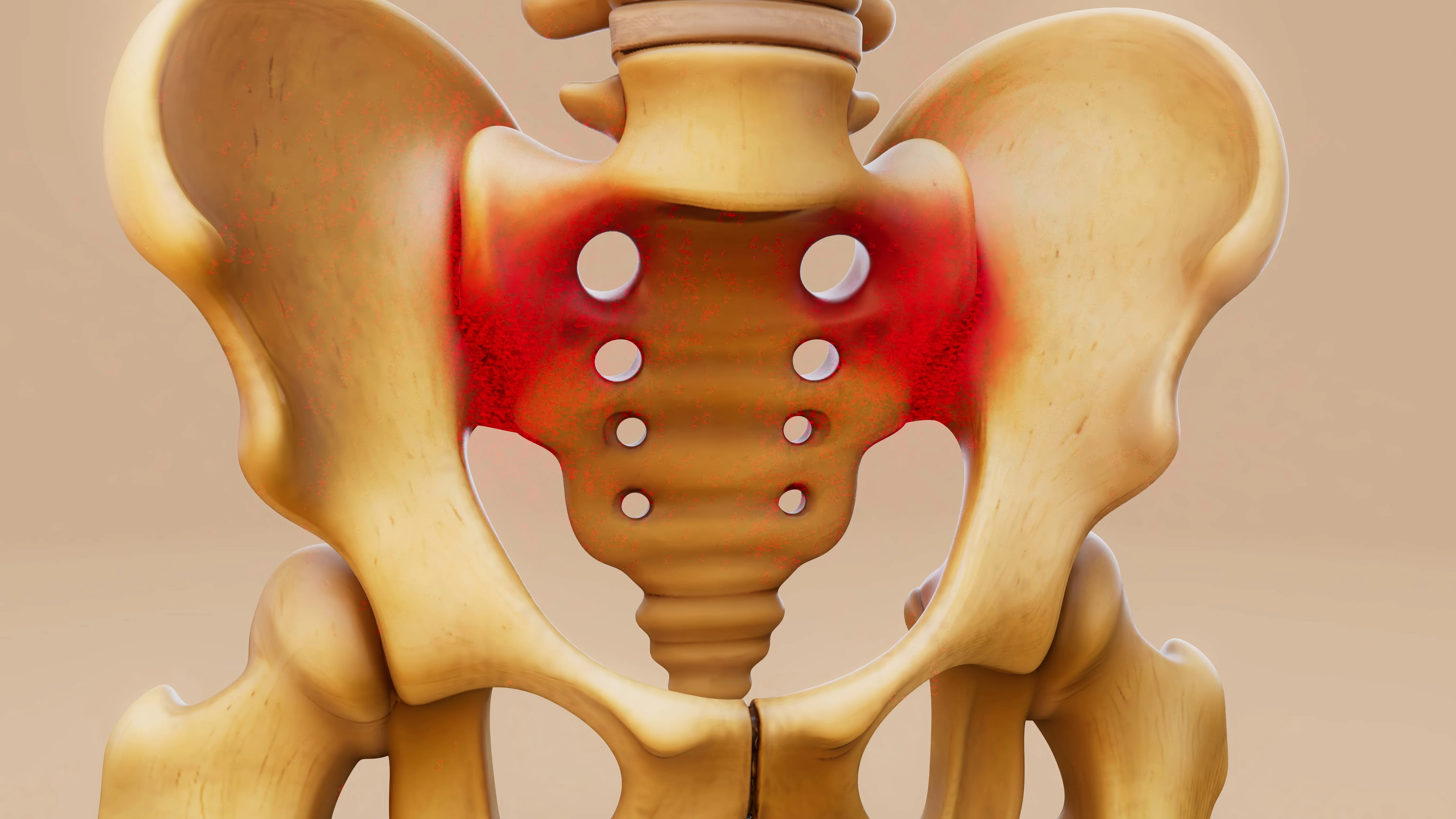 Čo je kokcygodýnia syndróm kostrče?