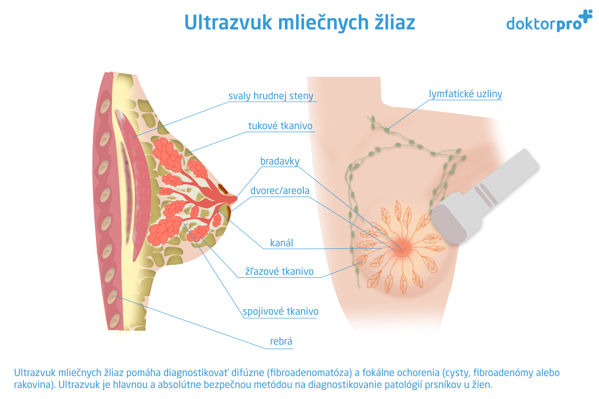 Čo  sonografia mliečnych žliazukazuje