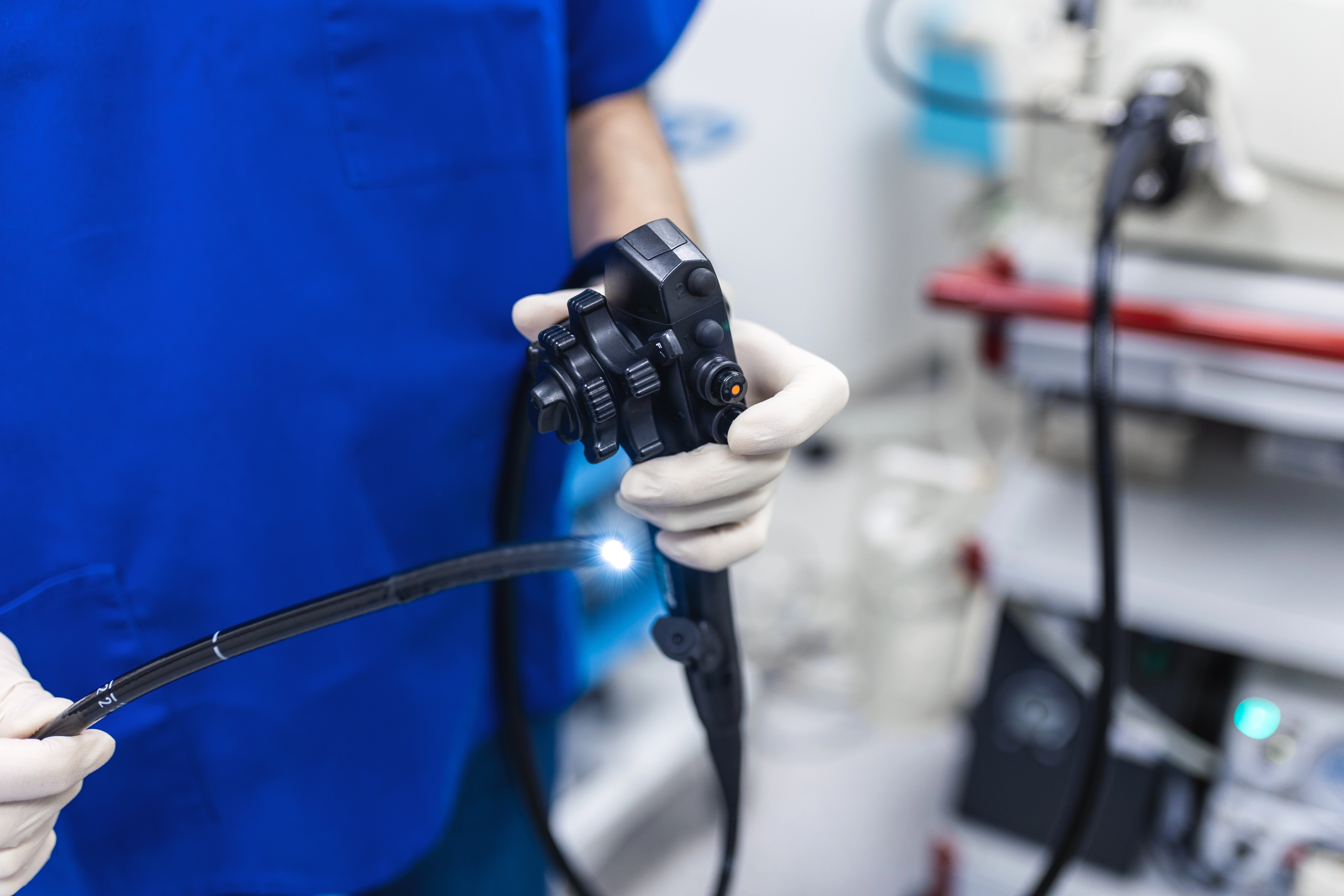 Prečo je dôležité podstúpiť kolonoskopiu po 50. roku života: prevencia rakoviny čriev