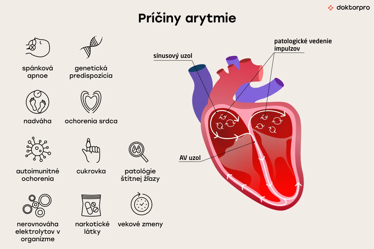 Príčiny arytmie