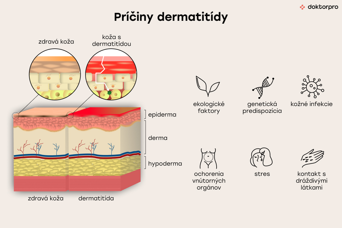 Príčiny deramtitídy