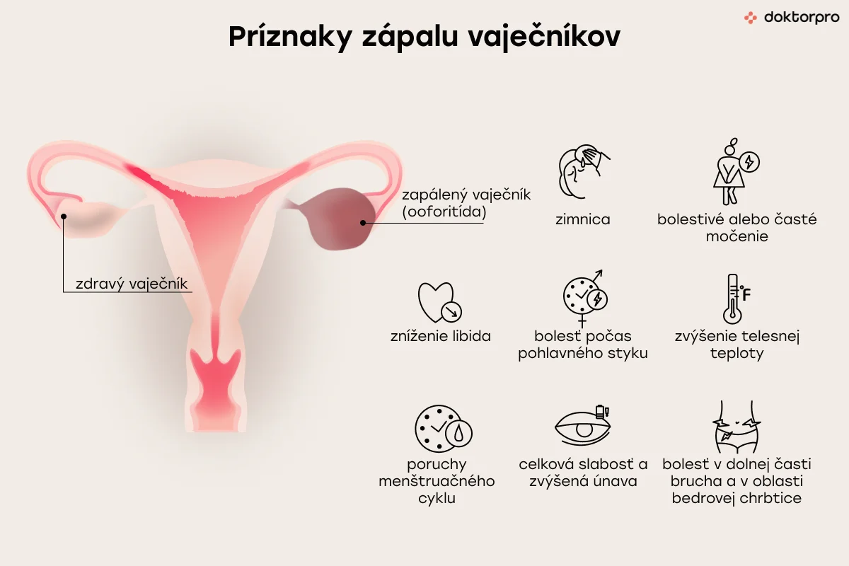 Príznaky zápalu vaječníkov