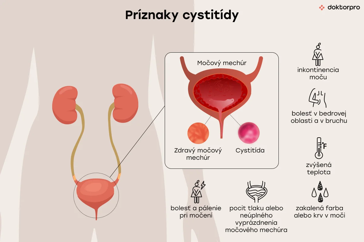 Príznaky cystitídy