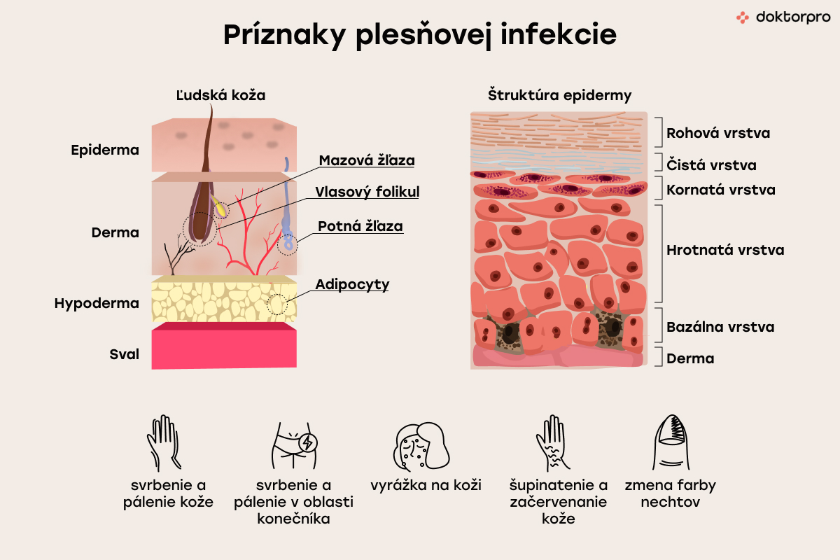 Príznaky plesňovej infekcie