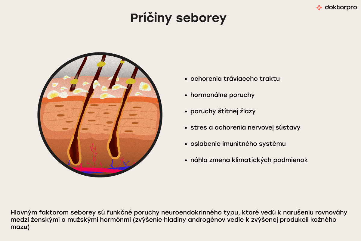 Príčiny seborey