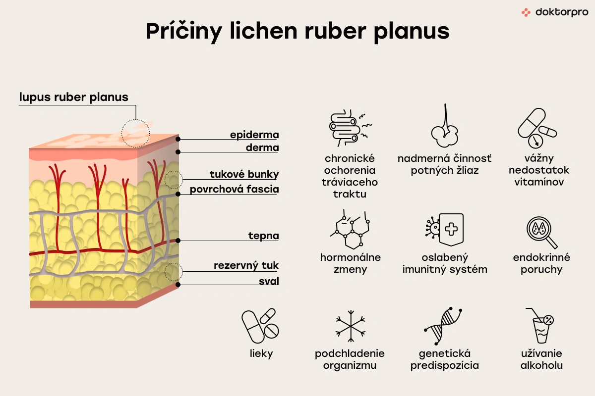 Príčiny lichen ruber planus