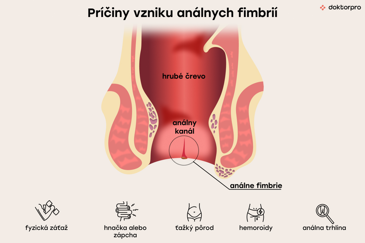Príčiny vzniku análnych fimbrií