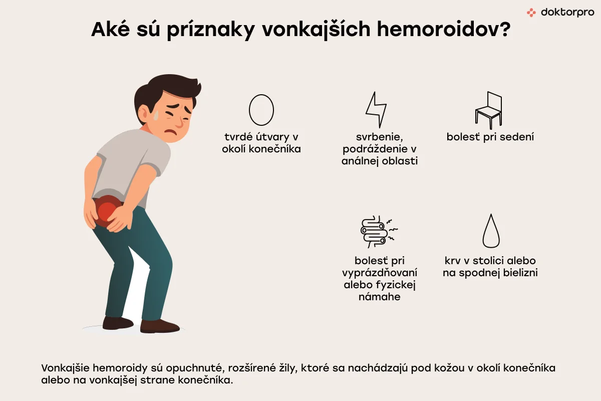 Aké sú príznaky vonkajších hemoroidov?