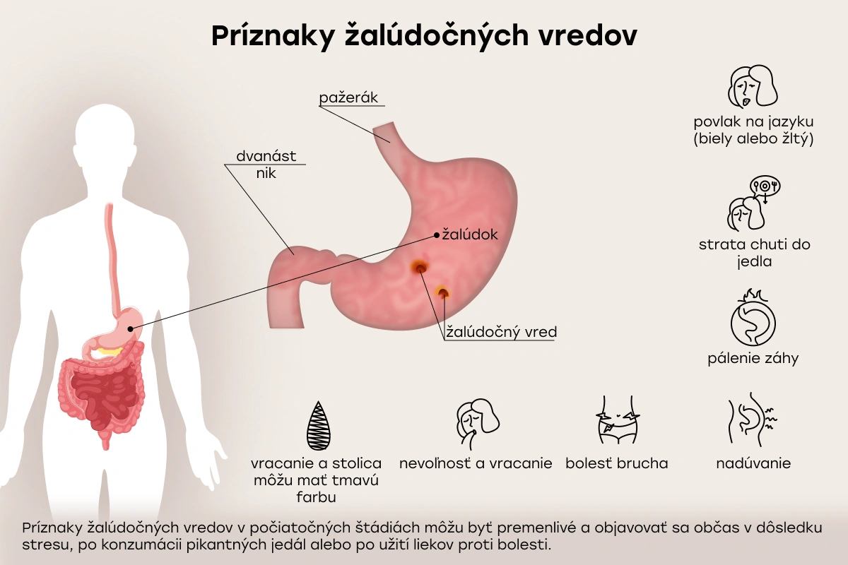 Príznaky žalúdočných vredov