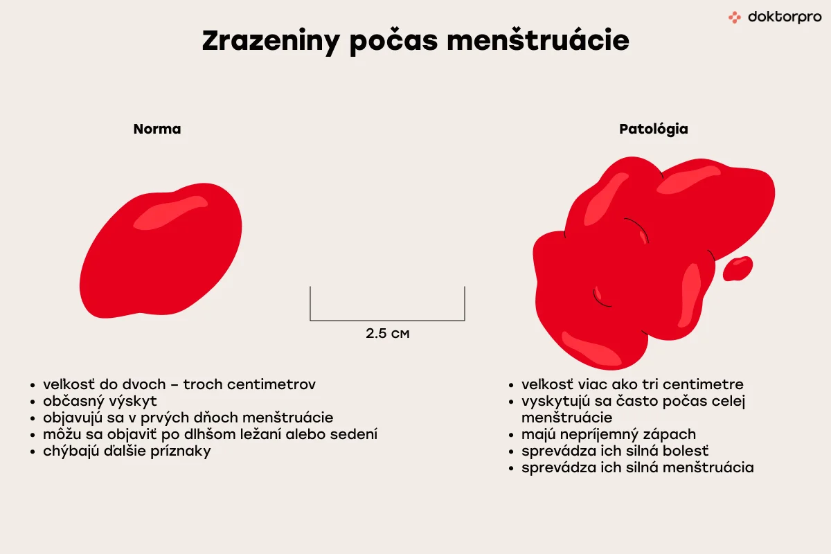 Zrazeniny počas menštruácie