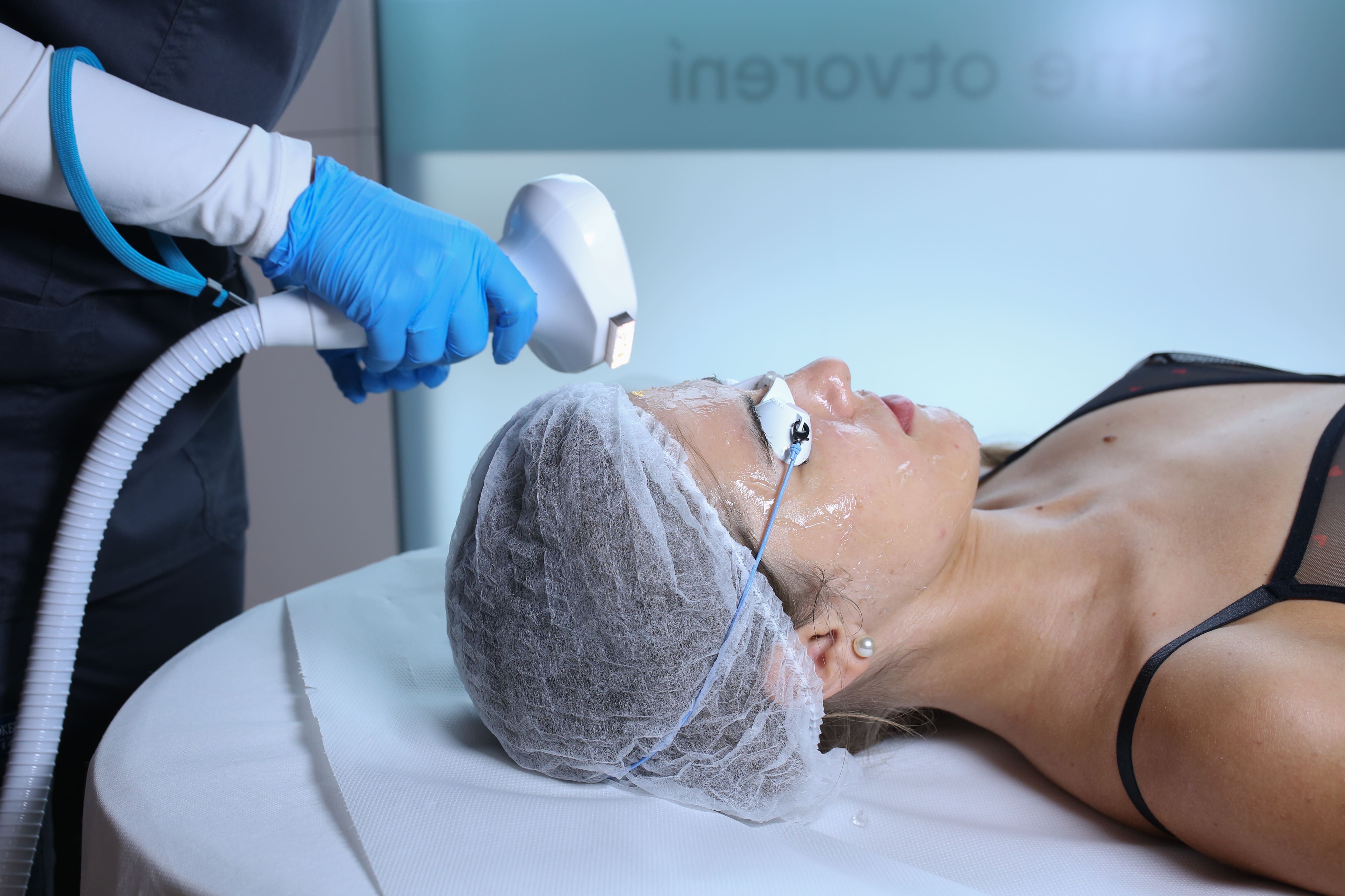 Fotorejuvenizácia (laserové omladenie) tváre IPL Lumecca v Bratislave