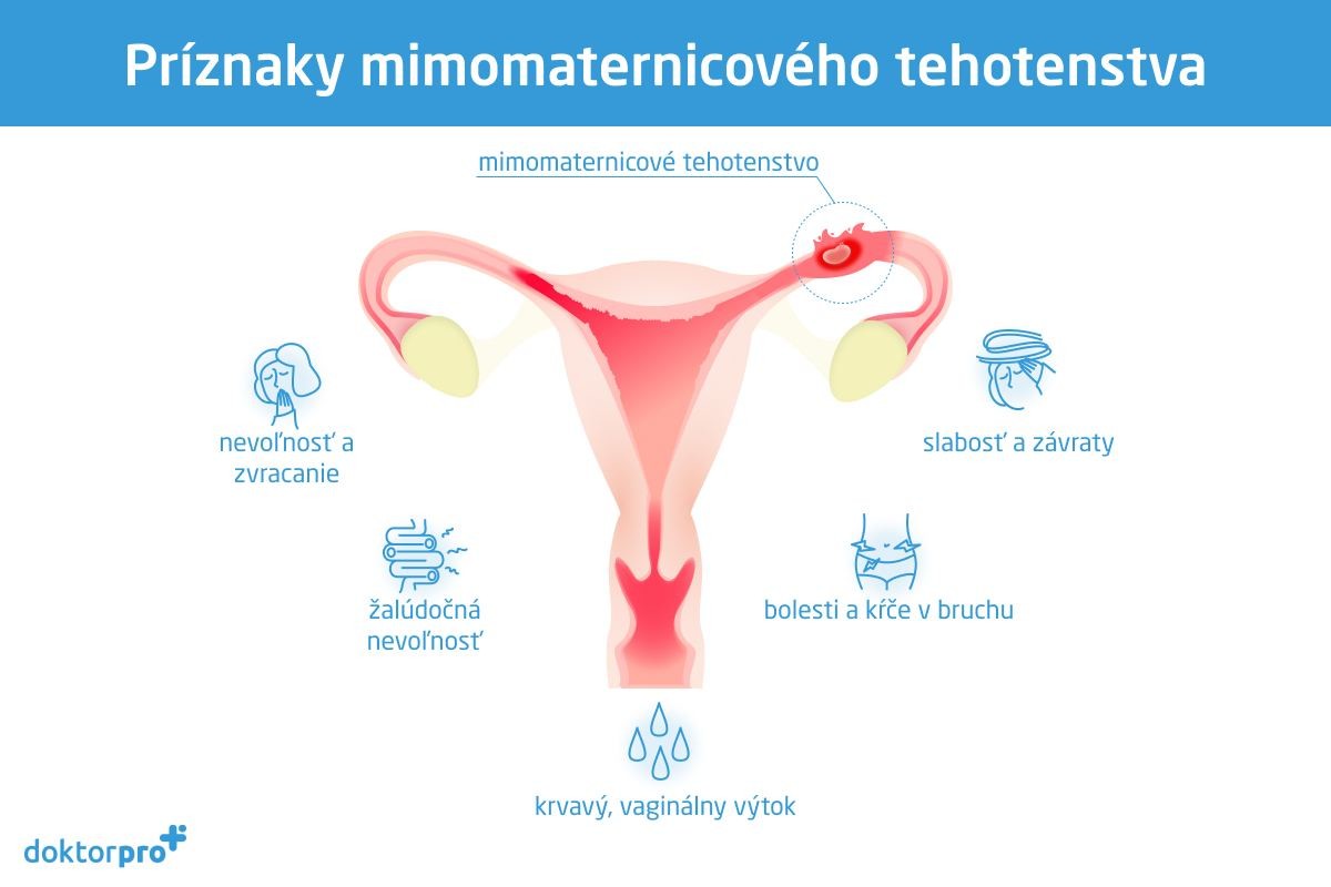 Príznaky mimomaternicového tehotenstva