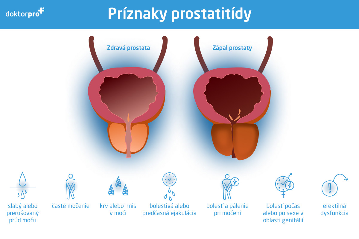 Príznaky prostatitídy