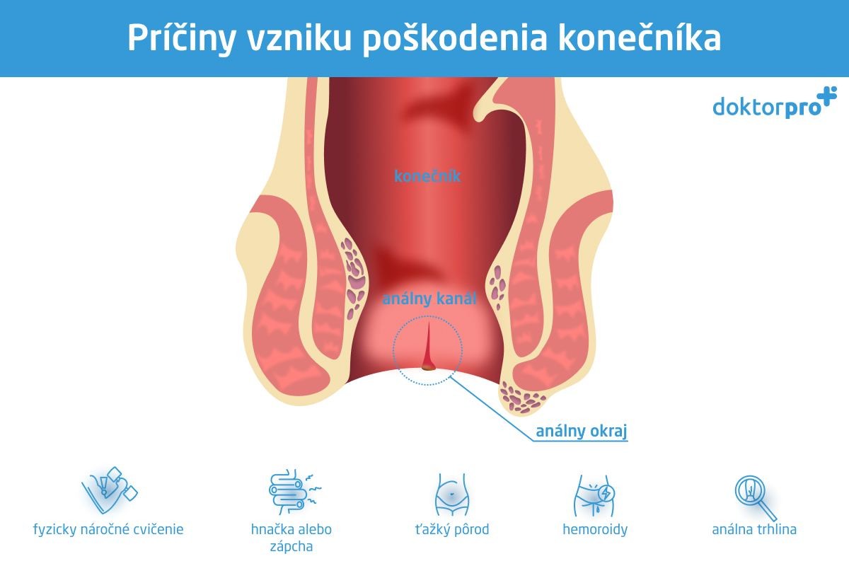 Príčiny vzniku poškodenia konečníka