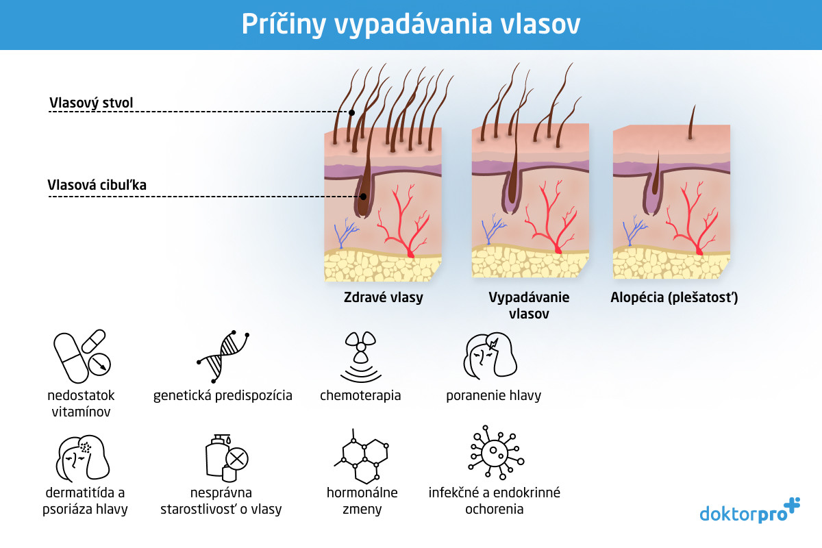 Príčiny vypadávania vlasov