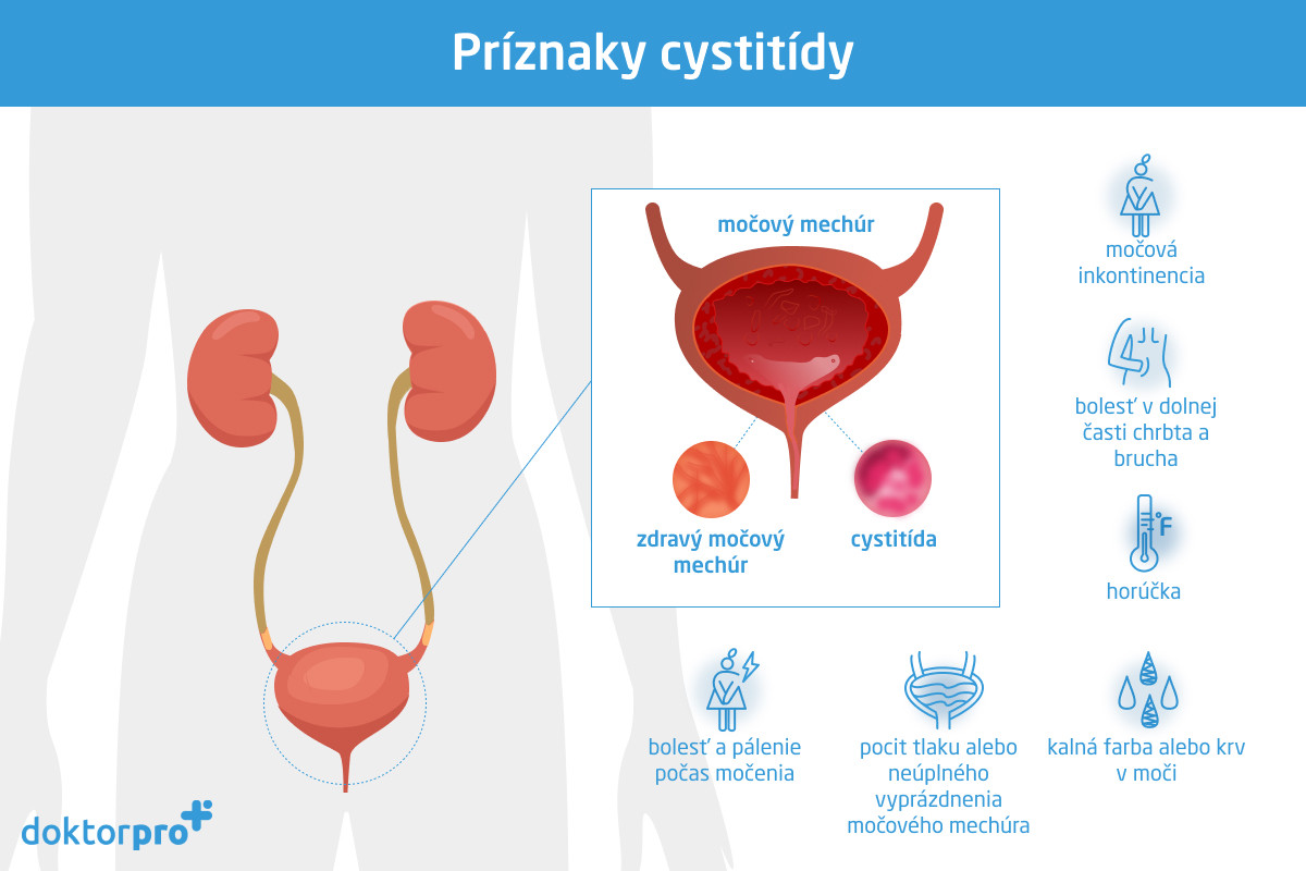 Príznaky cystitídy