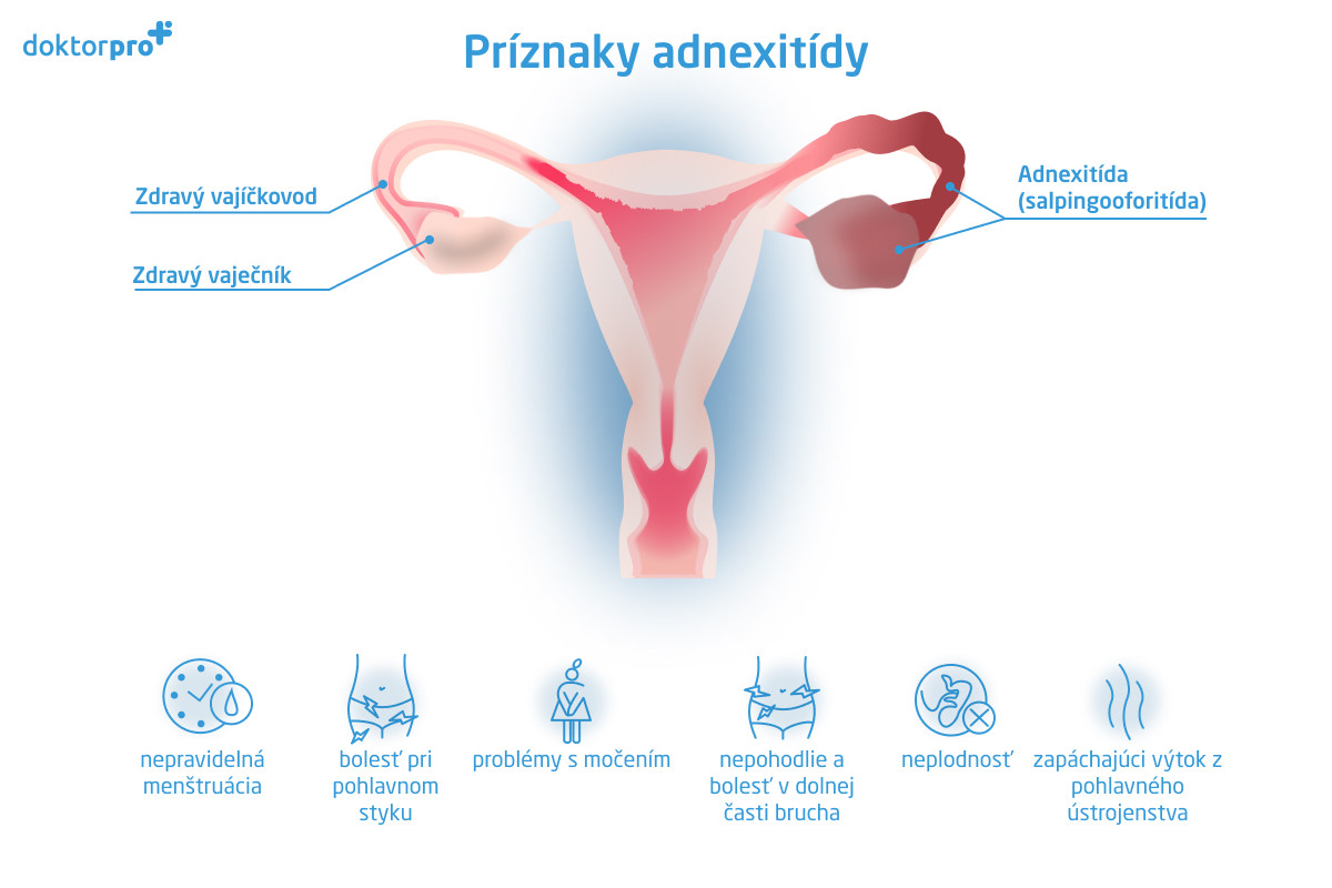 Príznaky adnexitídy