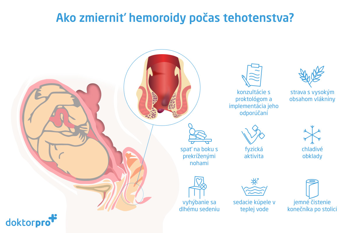 Ako zmierniť hemoroidy počas tehotenstva?