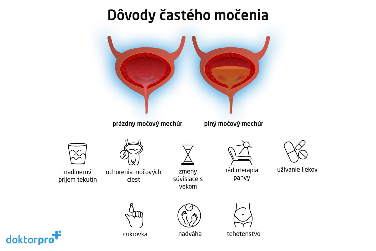 Dôvody častého močenia