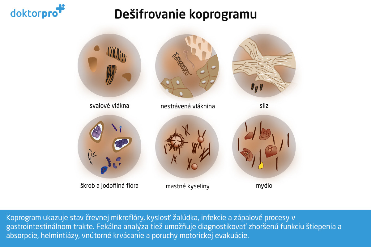 Dešifrovanie koprogramu