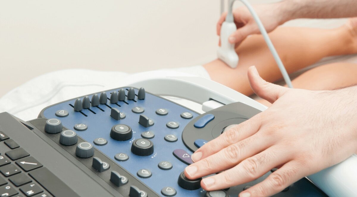 Ako sa vykonáva dopplerografia (ultrazvuk ciev)?