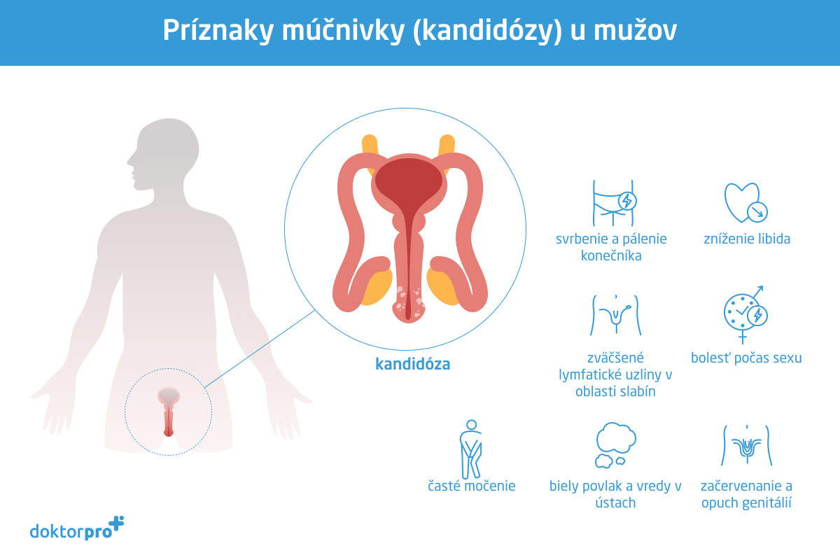 Príznaky múčnivky (kandidózy) u mužov