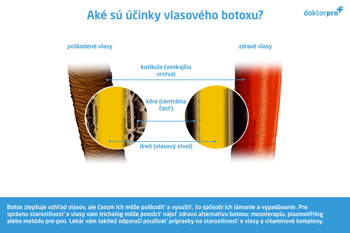 Aké sú účinky vlasového botoxu?