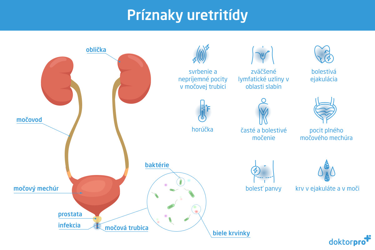 Príznaky uretritídy