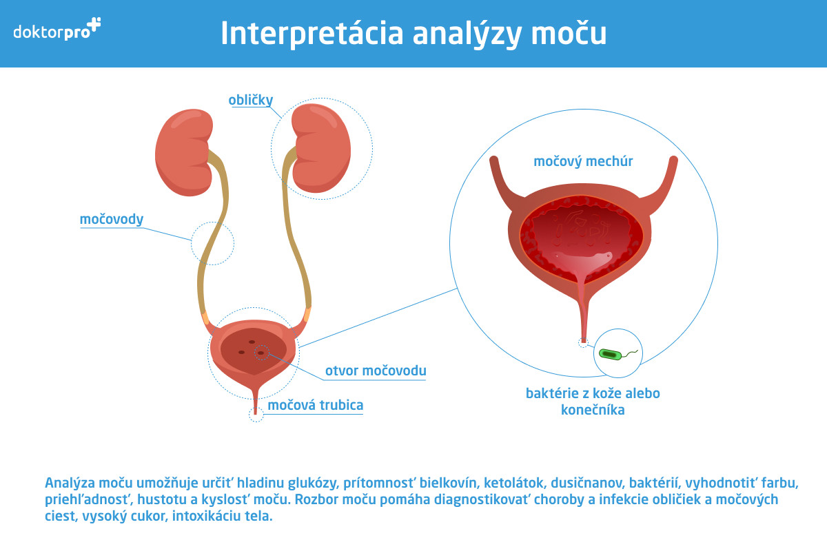 Interpretácia analýzy moču