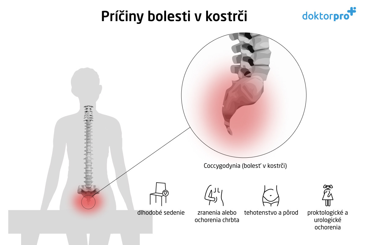 Coccygodynia (bolesť v kostrči)