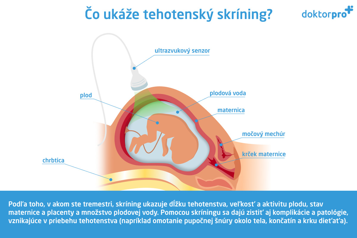 Čo ukáže tehotenský skríning?