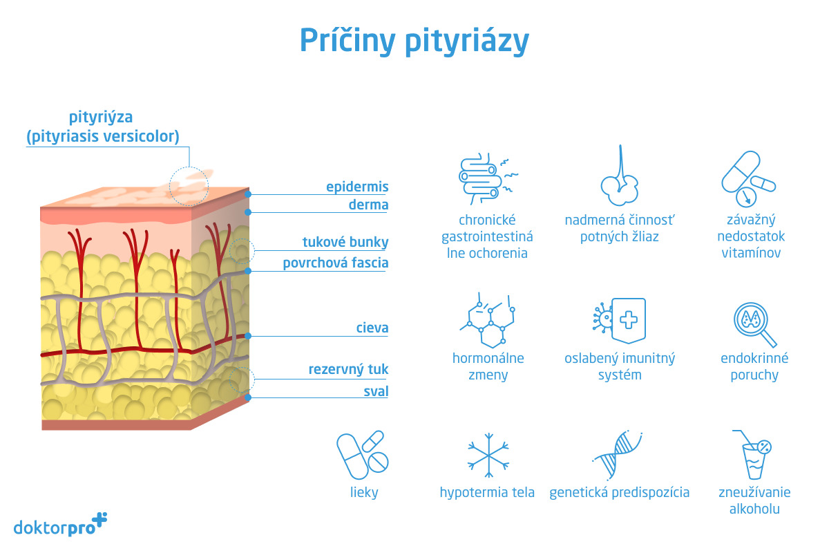 Príčiny pityriázy