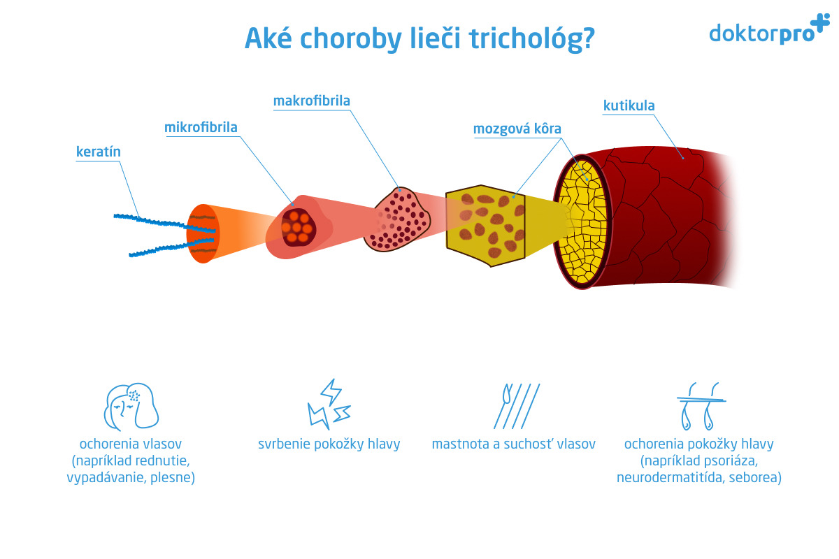 Aké choroby lieči trichológ?