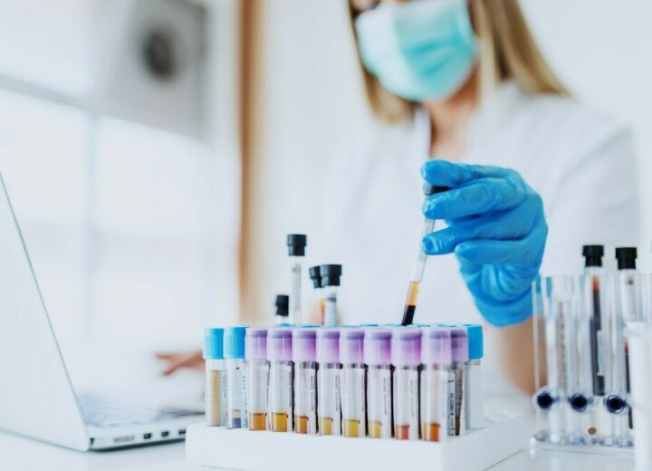 Aké krvné testy existujú a ako im porozumieť?