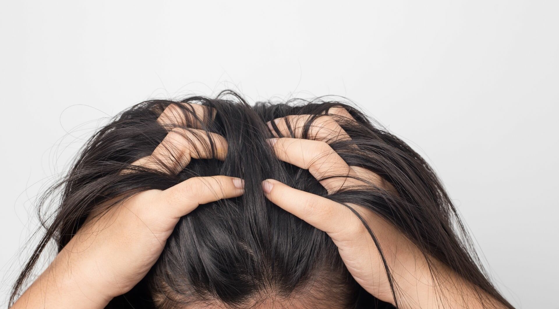 6 príčin svrbenia pokožky hlavy