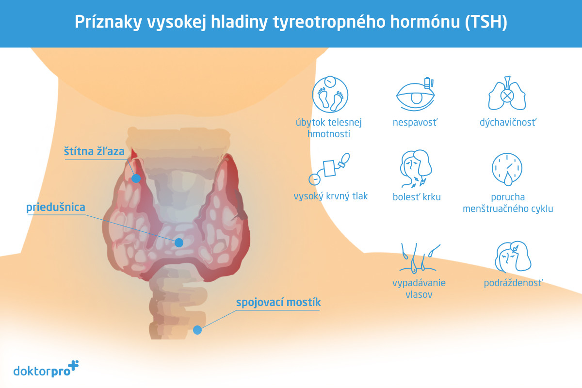 Príznaky vysokej hladiny tyreotropného hormónu (TSH)