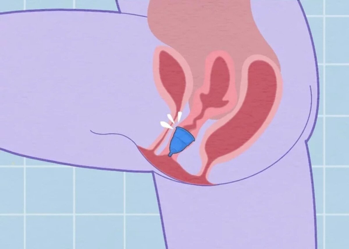 Krok 4. Uistite sa, že menštruačný kalíšok je správne umiestnený vo vagíne